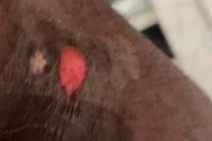 詹姆斯自拍展示右腿上的伤口:可能是年度最佳扑球造成的!好痛!